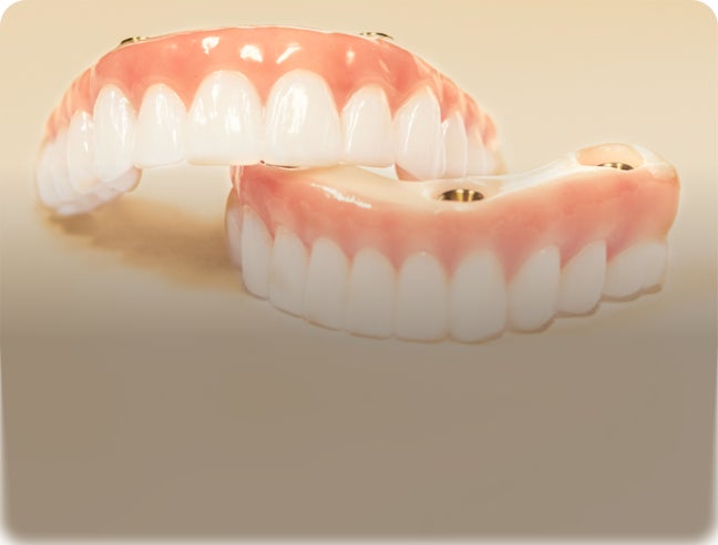 Custom dental implants full arch zirconia prosthesis with text “Custom dental implants. Every shape. Every shade.”