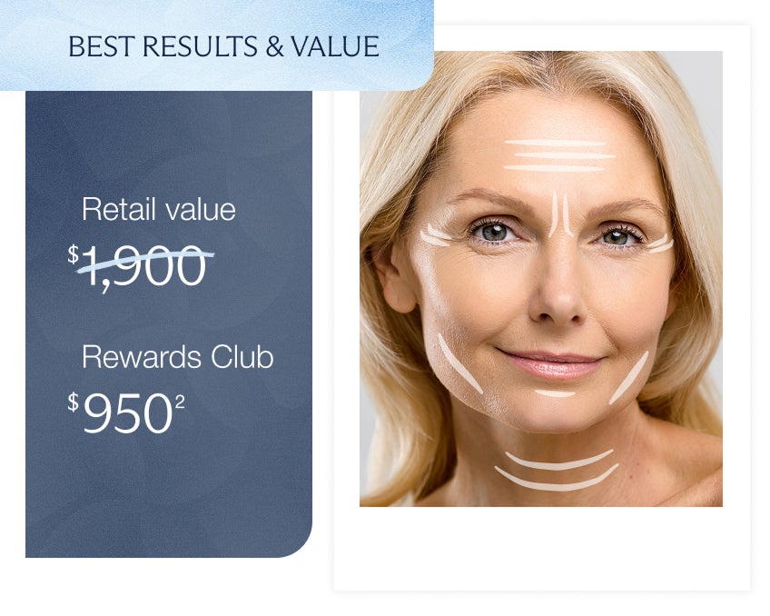 A smiling woman with Botox treatment areas highlighted across her face, next to a promotional graphic which reads 'Best results and value - retail value $1,900 - rewards club $950" emphasizing savings for Rewards Club members