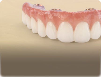ClearChoice Endura Elite full-arch zirconia dental implant prosthesis shown on a neutral background.