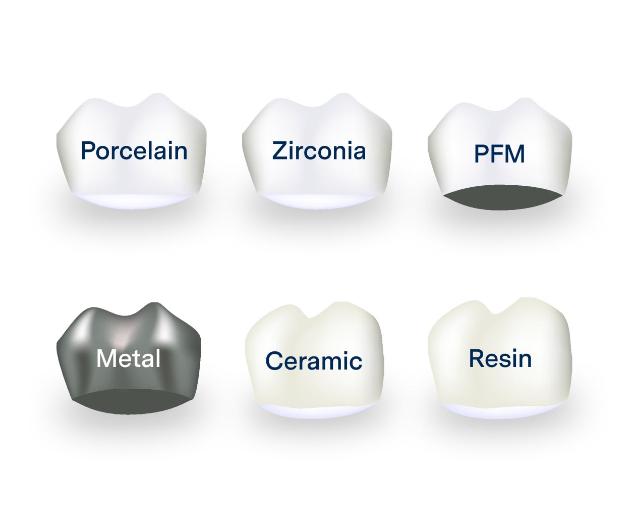 An illustration showing common dental crown materials - porcelain, zirconia, PFM, metal, ceramic, and resin