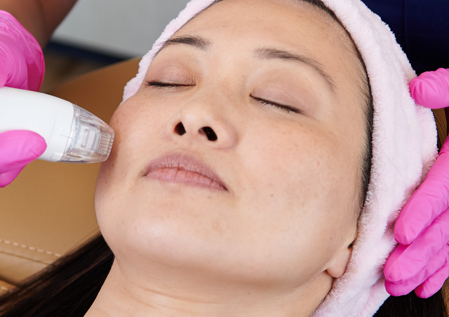 Guest receiving VirtueRF microneedling treatment at Chapter Aesthetic Studio, a skin rejuvenation procedure that improves texture, tone, and firmness with advanced radiofrequency technology.