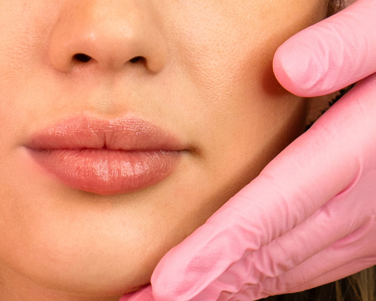 Close-up of lip filler injections at Chapter, highlighting smooth, hydrated lips with natural-looking results.