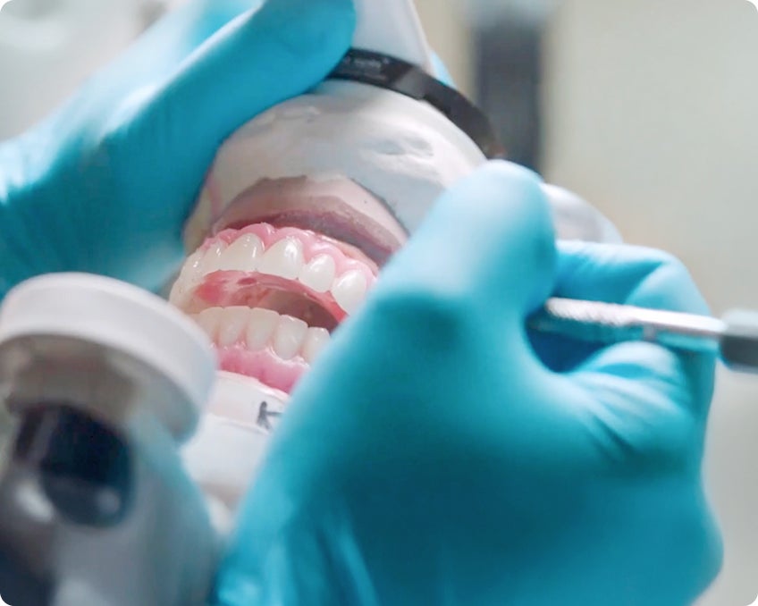 Close-up of a dental professional wearing gloves adjusting an implant-supported restoration on a dental model, demonstrating precision work during the dental implant process.