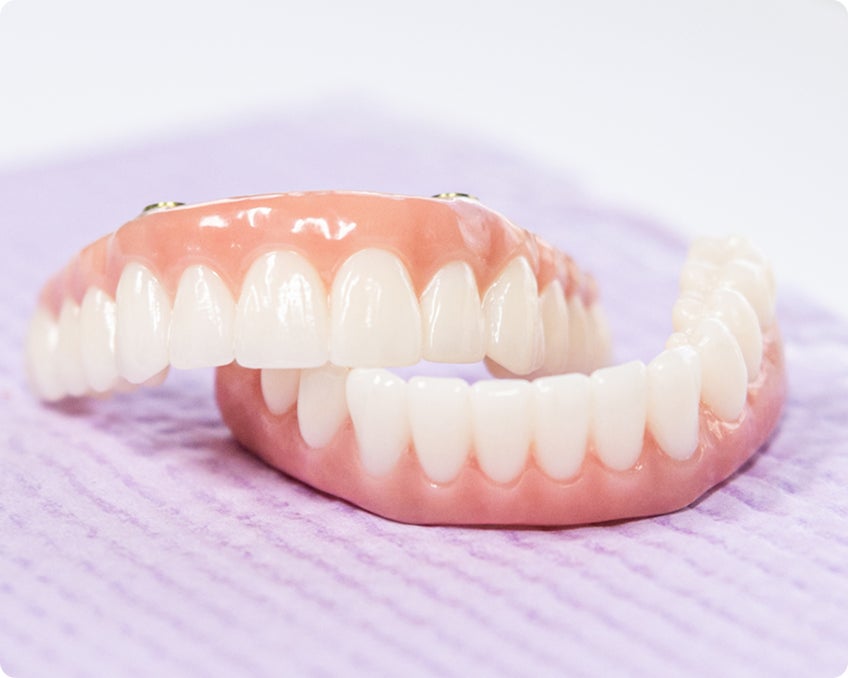 Upper and lower full-arch dental implant restorations with realistic gum contours and integrated implant connection points, displayed against a white background.