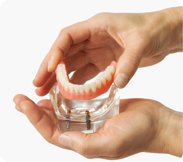 A pair of hands holds a lower denture model above a clear base showing two dental implants, demonstrating how implant-supported dentures attach securely.