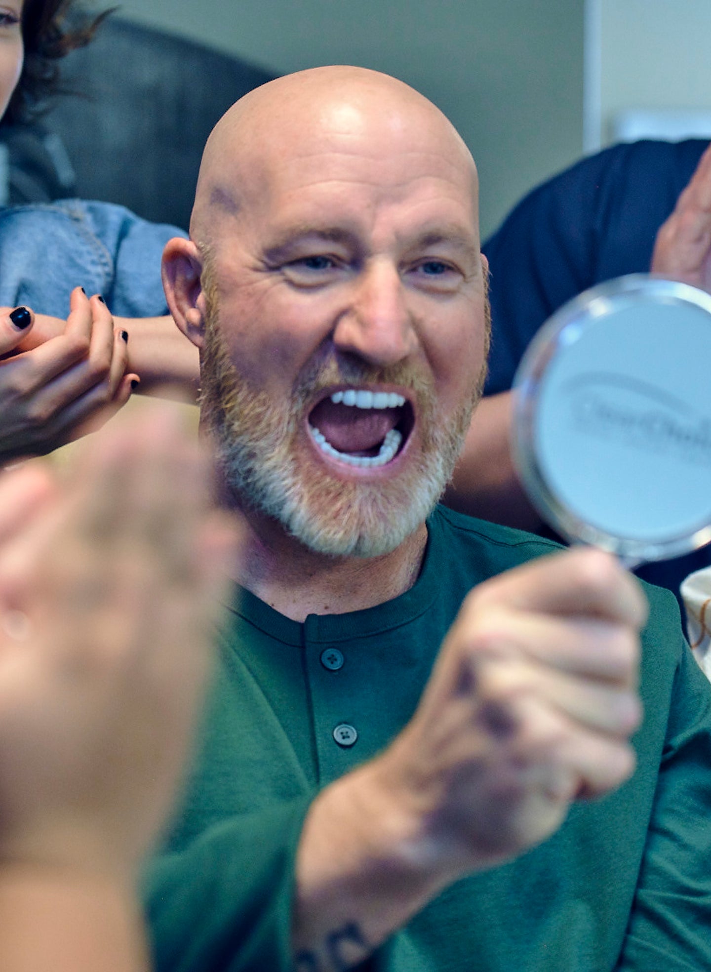 Why more people choose dental implants to start the new year