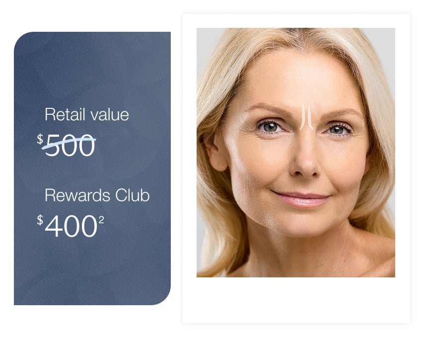 A smiling woman with Botox treatment areas highlighted on her forehead, next to a promotional graphic which reads "Retail value $500 - rewards club $400" emphasizing a discount for Rewards club members
