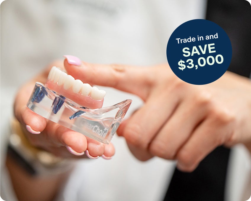 Hand holding a ClearChoice dental implant model while pointing to it, with on-image text reading “Trade in and SAVE $3,000,” illustrating a ClearChoice trade-in savings offer for dental implants.