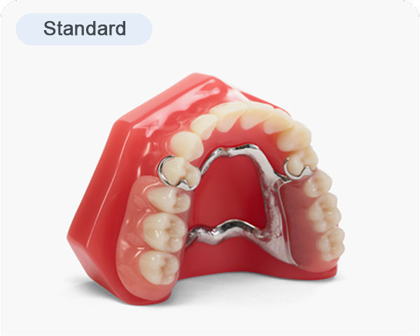 Standard partial dentures for Aspen Dental, featuring a metal framework with artificial teeth set in a pink, gum-colored base, designed to replace missing teeth and restore function.