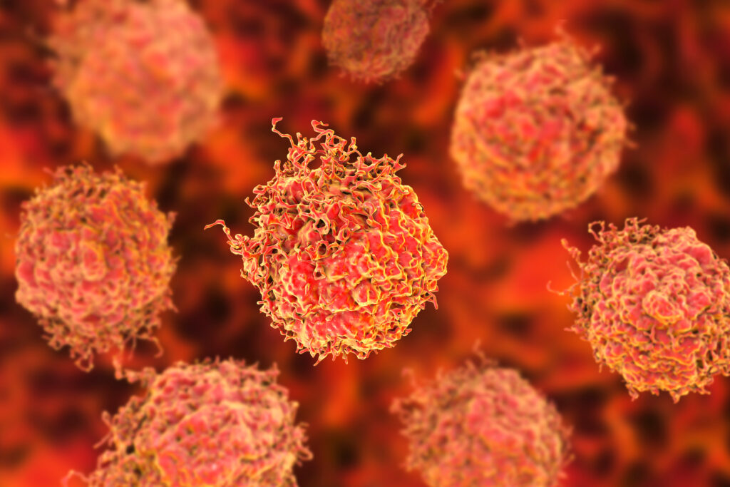 Prostate Cancer Cells.