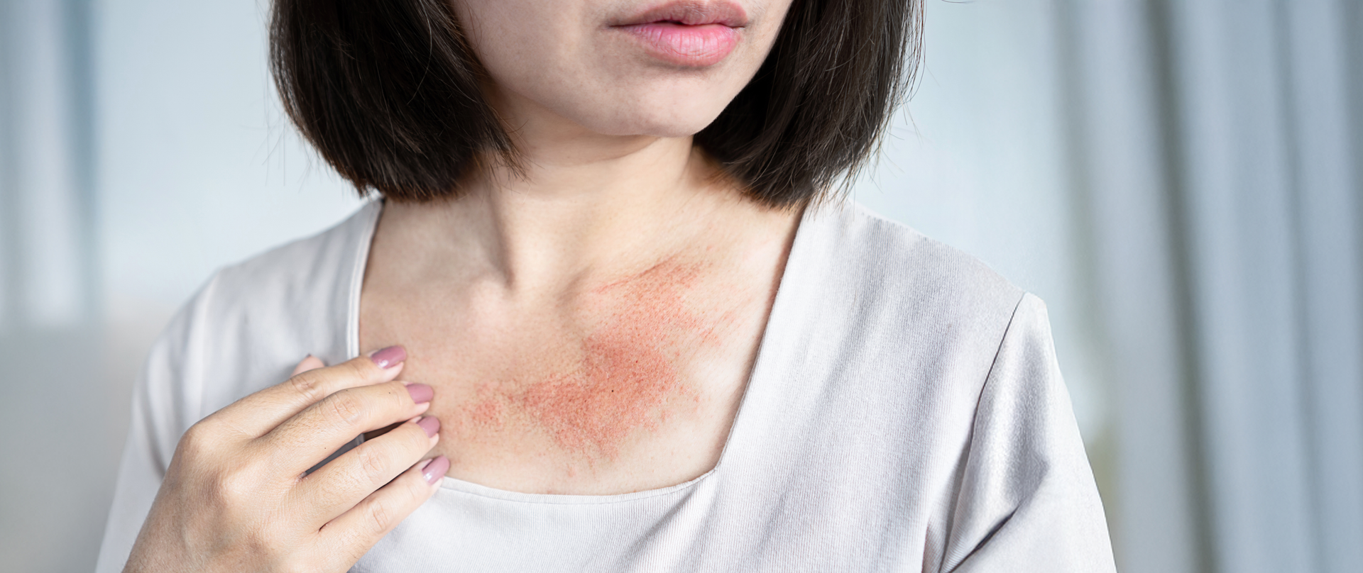 A targeted sales strategy optimized field operations in the allergy-immunology therapeutic area.