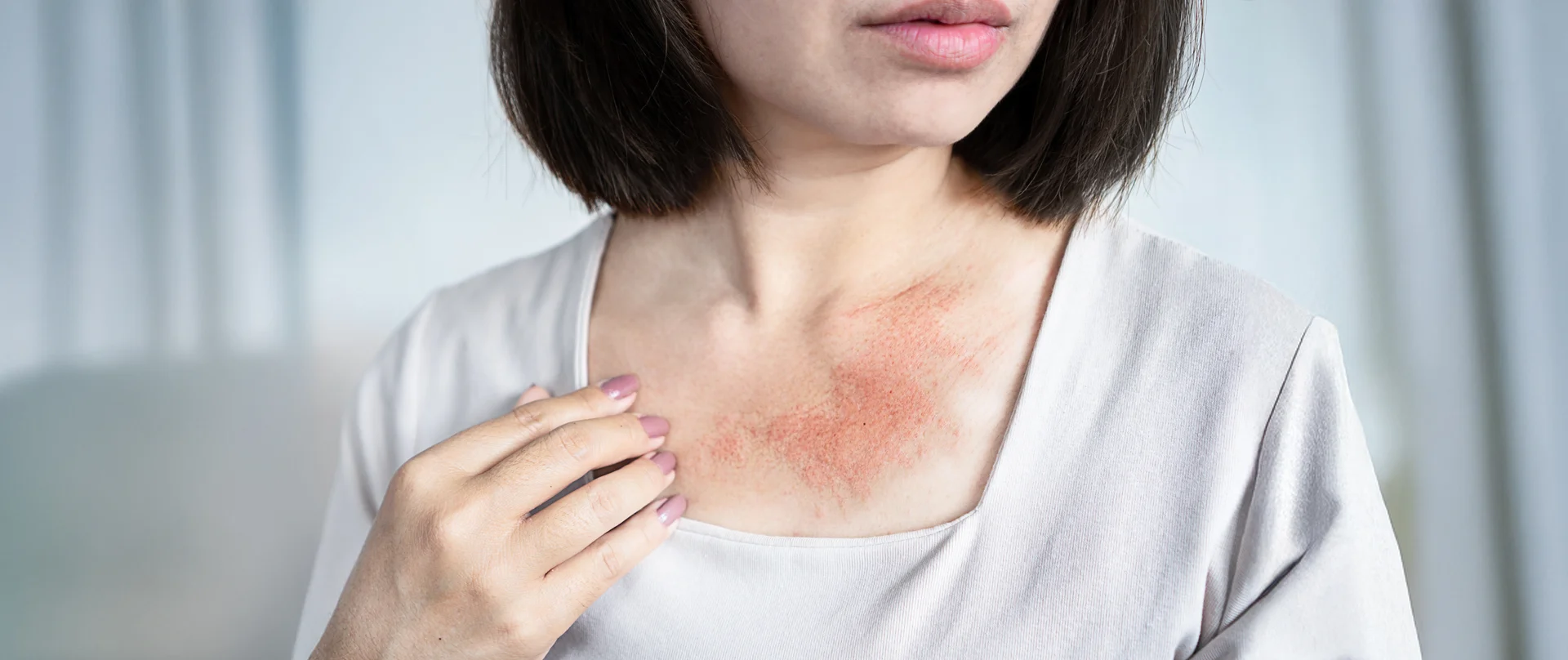 A targeted sales strategy optimized field operations in the allergy-immunology therapeutic area.