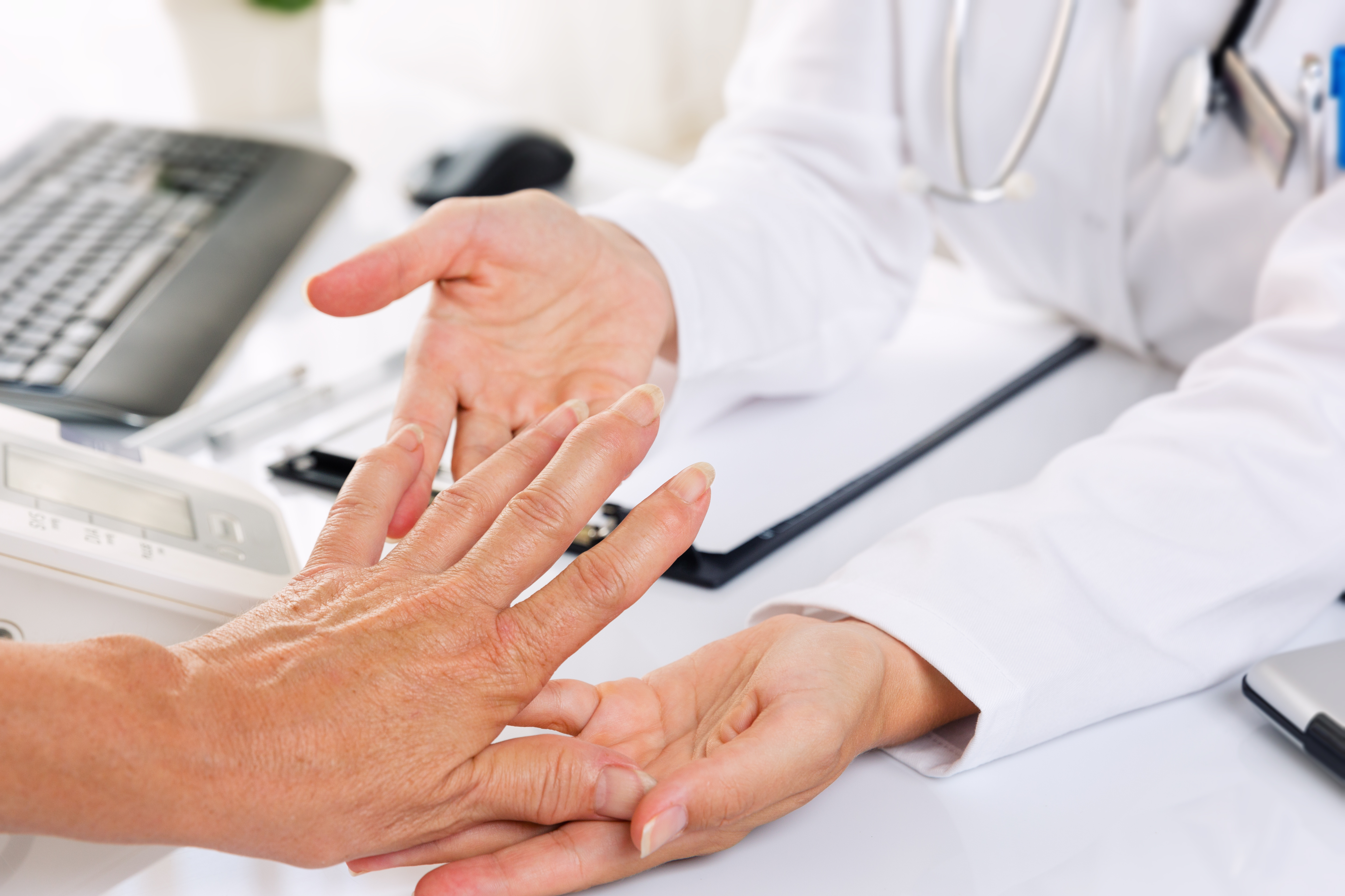 Doctor examining patient hands for Rheumatoid arthritis, which tends to affect the joints that attach your fingers to your hands and your toes to your feet.