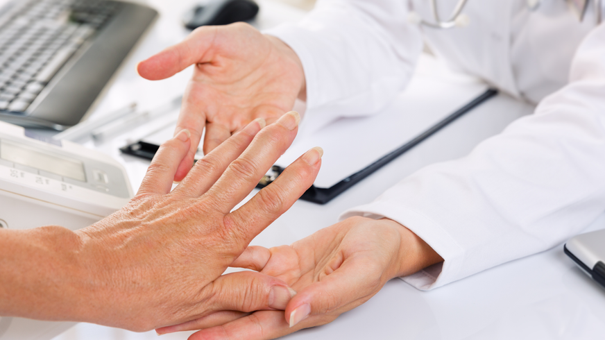 Doctor examining patient hands for Rheumatoid arthritis, which tends to affect the joints that attach your fingers to your hands and your toes to your feet.