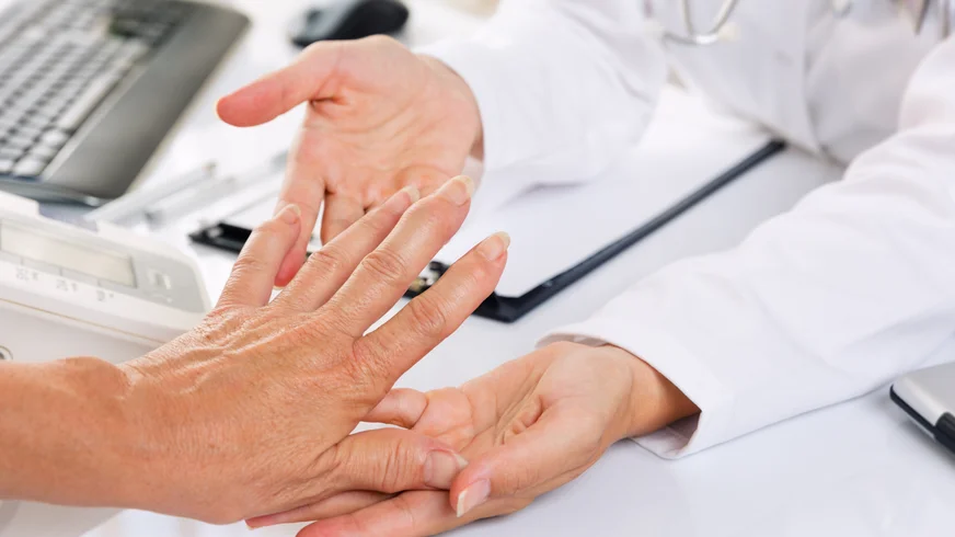 Doctor examining patient hands for Rheumatoid arthritis, which tends to affect the joints that attach your fingers to your hands and your toes to your feet.