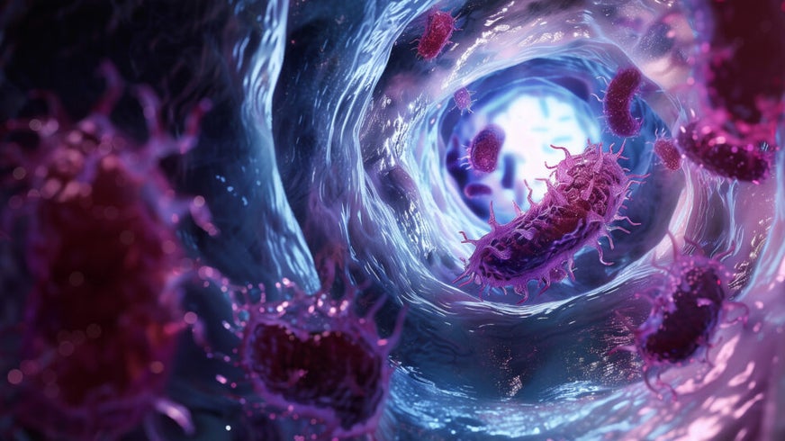 Holographic concept of colon cancer.