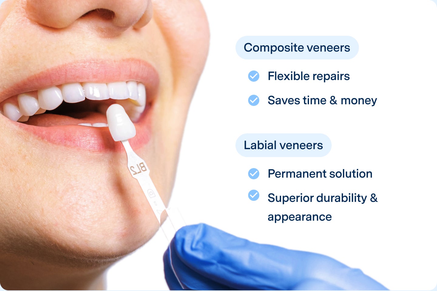 A patient undergoing dental lumineer shade matching, with a dentist using a shade guide to ensure a natural and precise fit, representing Aspen Dental's cosmetic dentistry services.