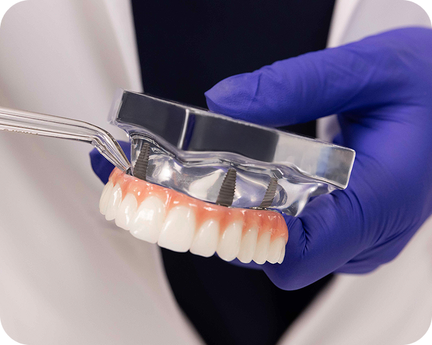 Demonstrating the use of a water flosser on a fixed full arch dental implant to clean between teeth – Aspen Dental implant hygiene tip.