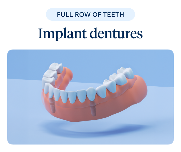 A 3D illustration of implant dentures showing a full row of teeth, representing Aspen Dental's solution for complete tooth replacement.