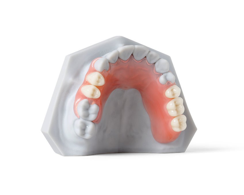 Partial dentures model featuring an upper dental arch with artificial teeth and a pink gum base set in a gray mold.