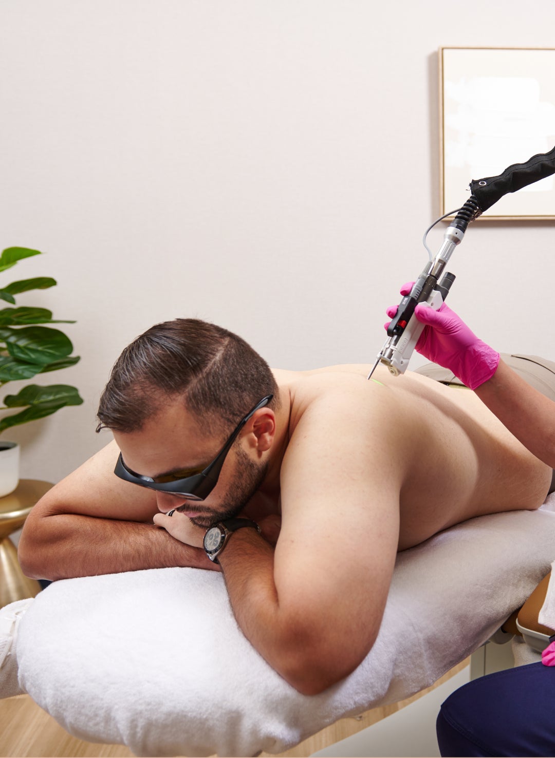 A man receiving laser hair removal treatment at a Chapter Aesthetic Studio on his back.