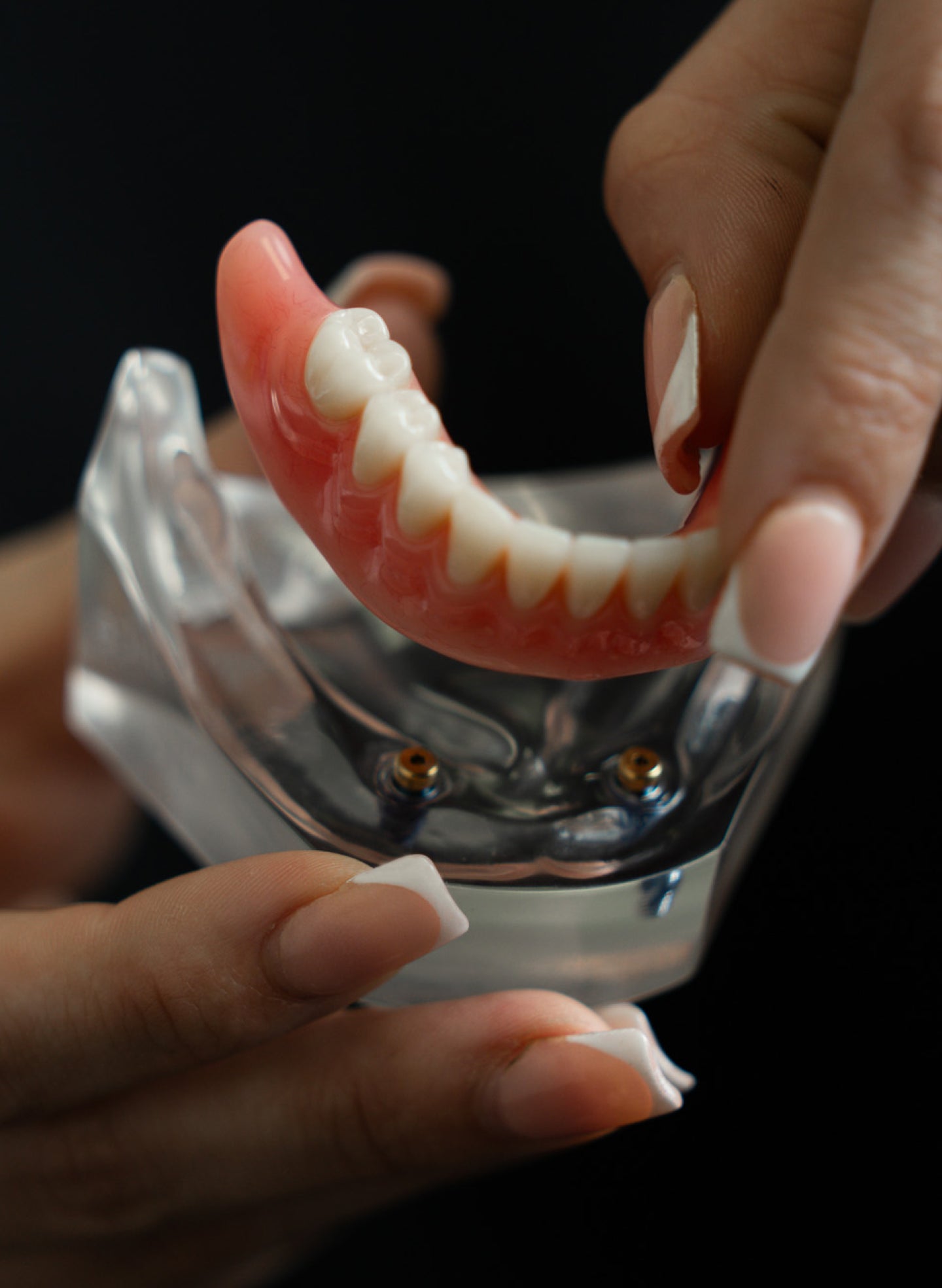 A ClearChoice specialist demonstrates a lower arch implant denture model to show how implant dentures fit securely in the mouth.