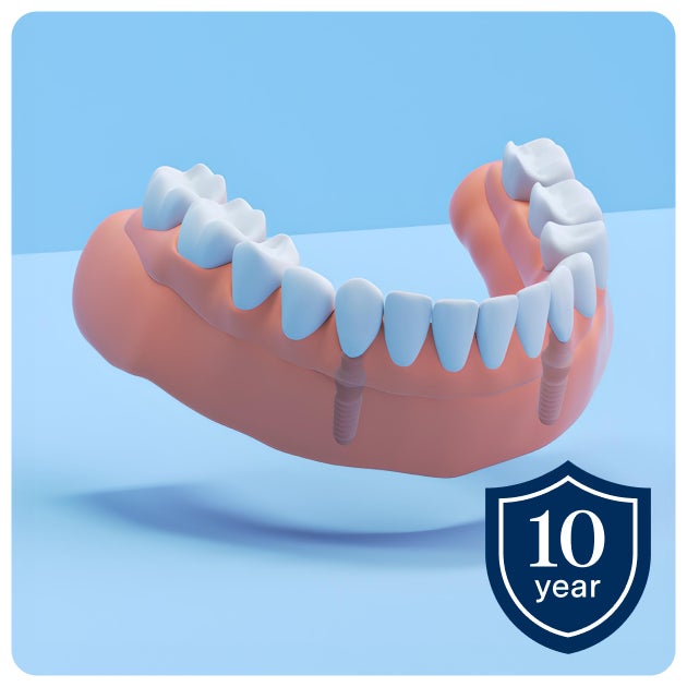 Illustration of a fixed full arch dental implant showcased on two implant posts in the lower jaw and a row of teeth. A shield icon with a 10-year guarantee is shown in the bottom right corner.