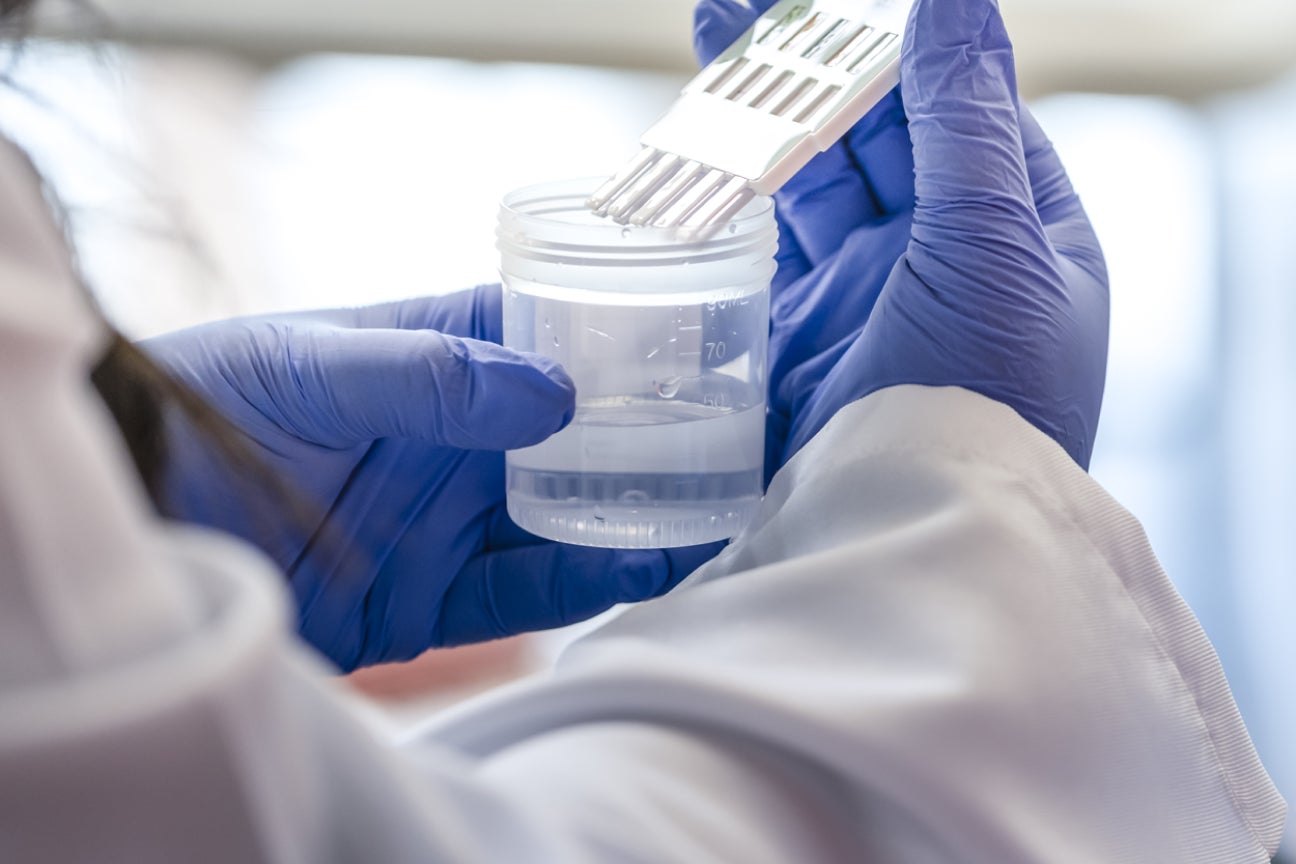 A close up image of a lab technician running tests on medical samples.