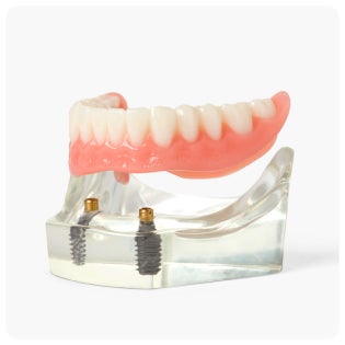 A model of a denture with two dental implants