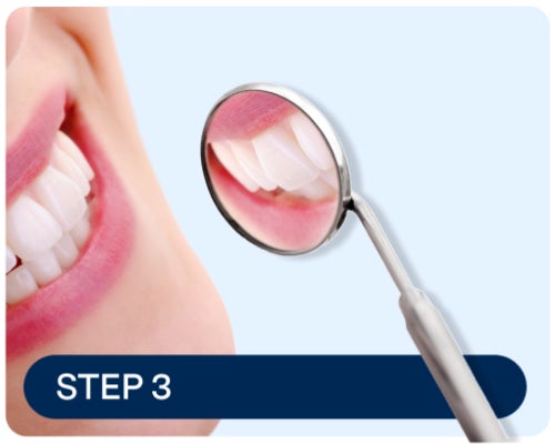 Close-up of a dental checkup using a mirror tool, emphasizing the importance of regular dental visits for maintaining the brightness and health of composite veneers.