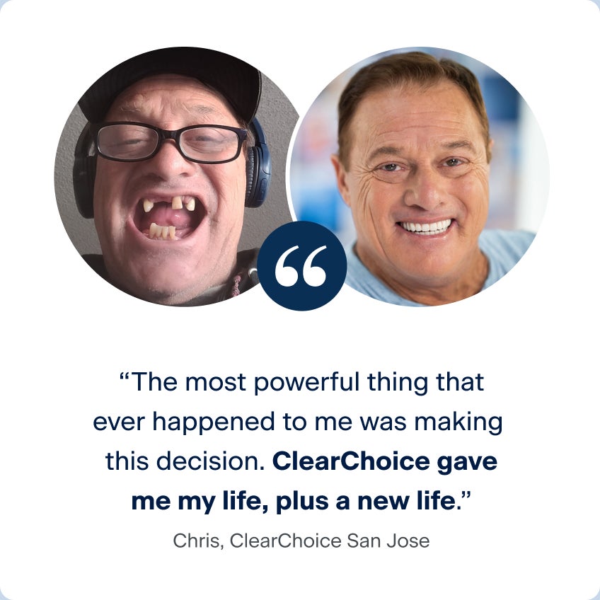 Before-and-after photos of Chris from ClearChoice with a testimonial about gaining a new life, reflecting how AARP dental solutions transformed his smile and well-being.
