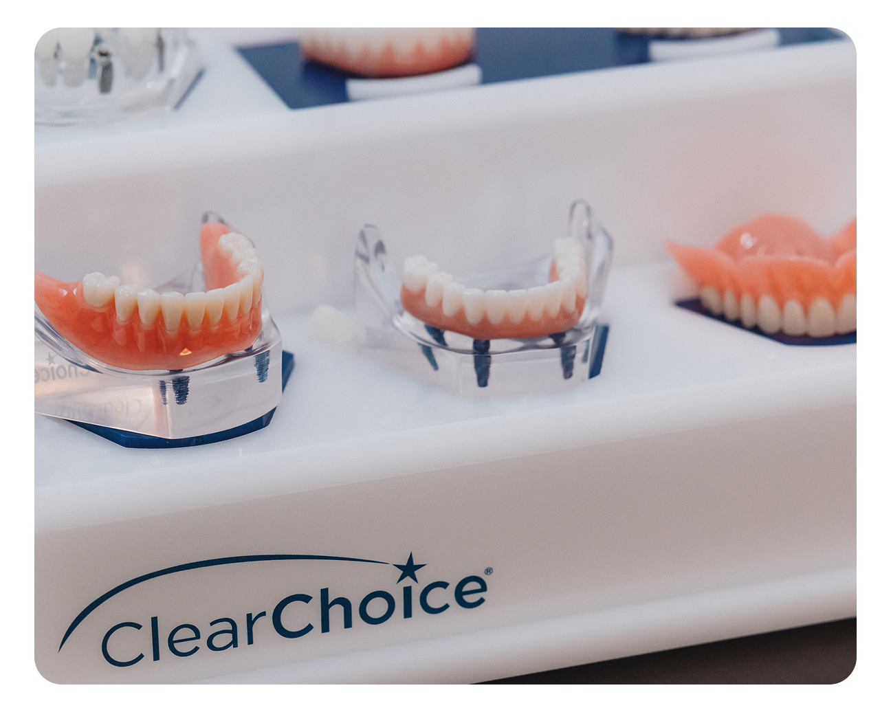 Close-up of hands holding a dental implant model while discussing costs at a ClearChoice clinic.