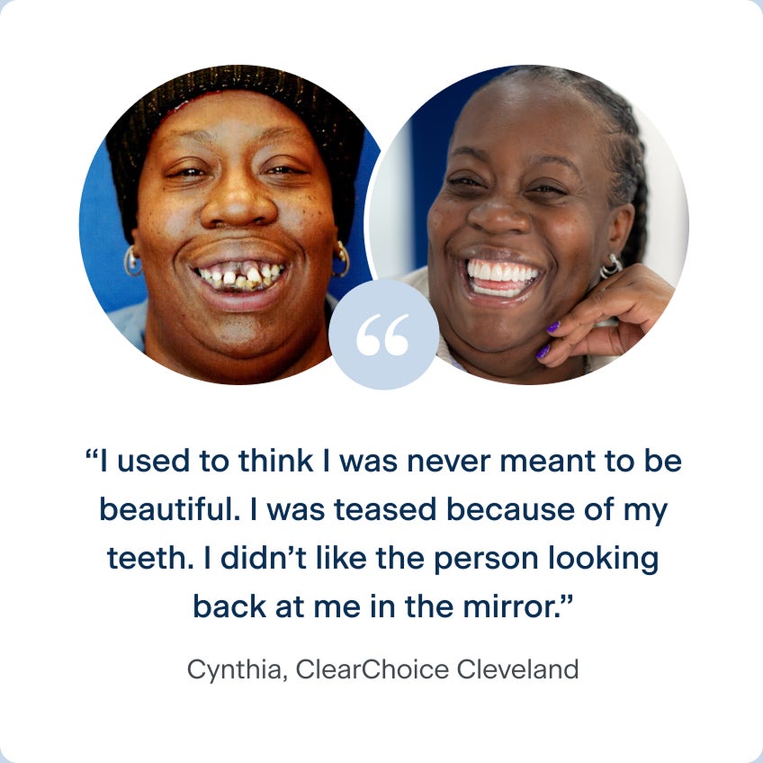 Images of Cynthia before and after receiving her dental implants, with her quote to describe her experience with ClearChoice: I used to think I was never meant to be beautiful. I was teased because of my teeth. I didn't like the person looking back at me in the mirror.