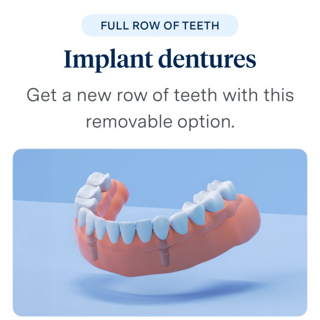 An advertisement for full row of teeth implant dentures