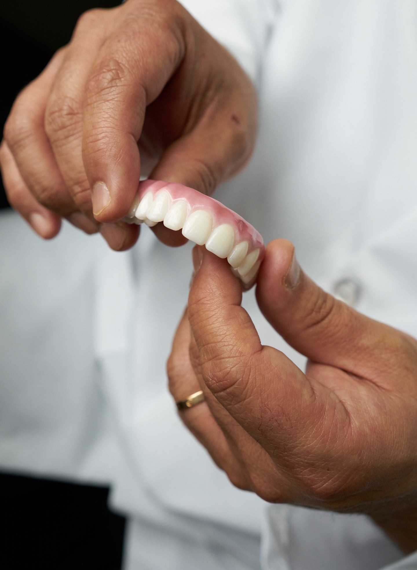 A close-up of a ClearChoice dentist's hands holding a dental prosthesis, showing the detailed structure of the artificial teeth and gums.