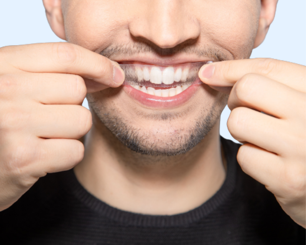 Male patient gently pulling back lips to reveal a healthy, white smile, showcasing Aspen Dental’s effective dental care results.