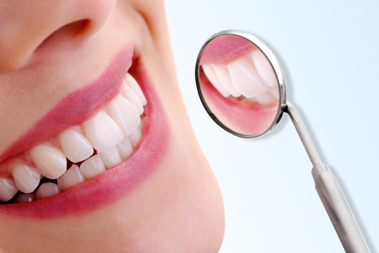 Close-up of a smiling person’s teeth being examined with a dental mirror at Aspen Dental, highlighting white teeth and healthy gums.