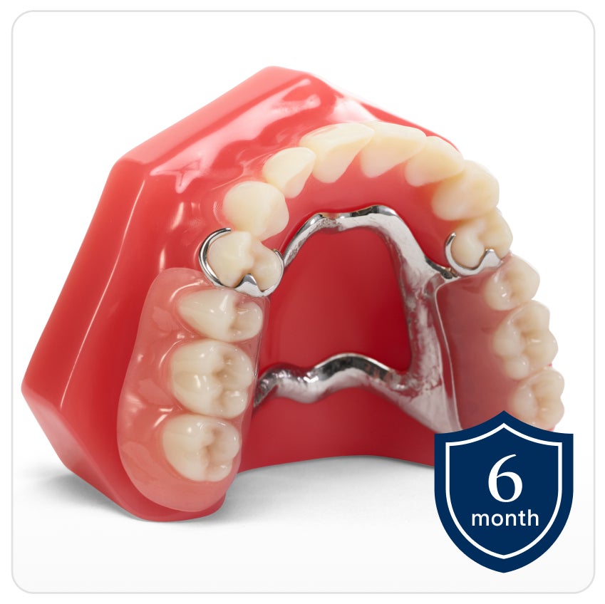 Cast partial denture showcased on upper denture model with metal clasps. A shield icon on bottom right with text that reads "6 month" indicating the warranty period.