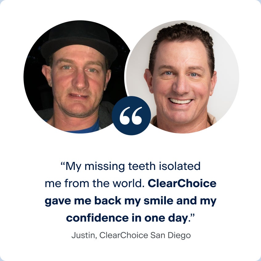 Justin highlights his ClearChoice journey with before-and-after photos, saying AARP dental implants restored his smile and boosted his confidence in one day.