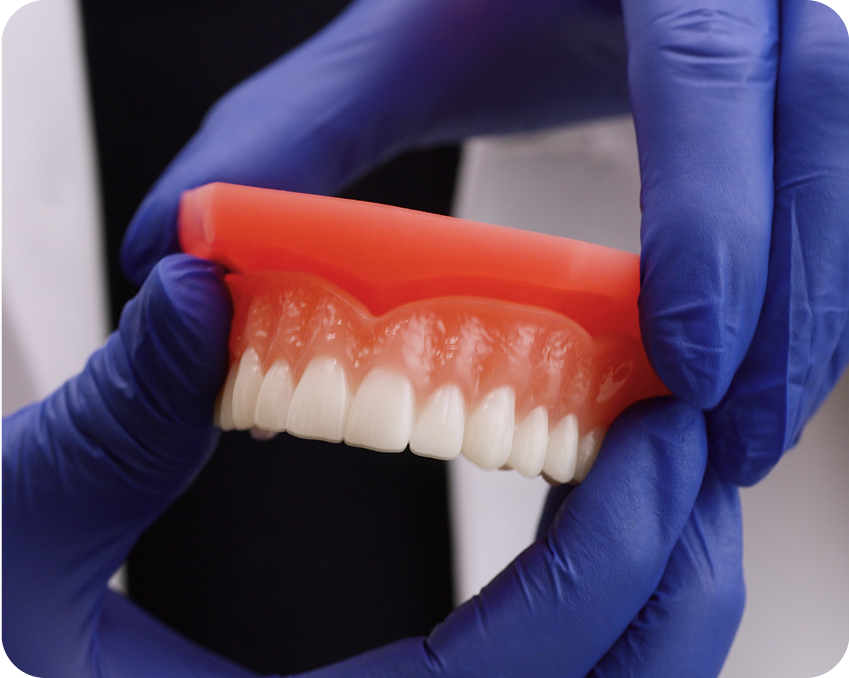 Gloved hand gently removing an upper denture – Aspen Dental denture care instruction