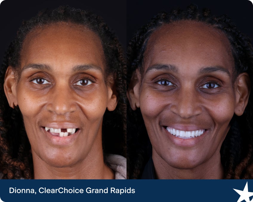 Dionna de ClearChoice Grand Rapids luce una sonrisa renovada tras recibir implantes dentales que cambiaron su vida.