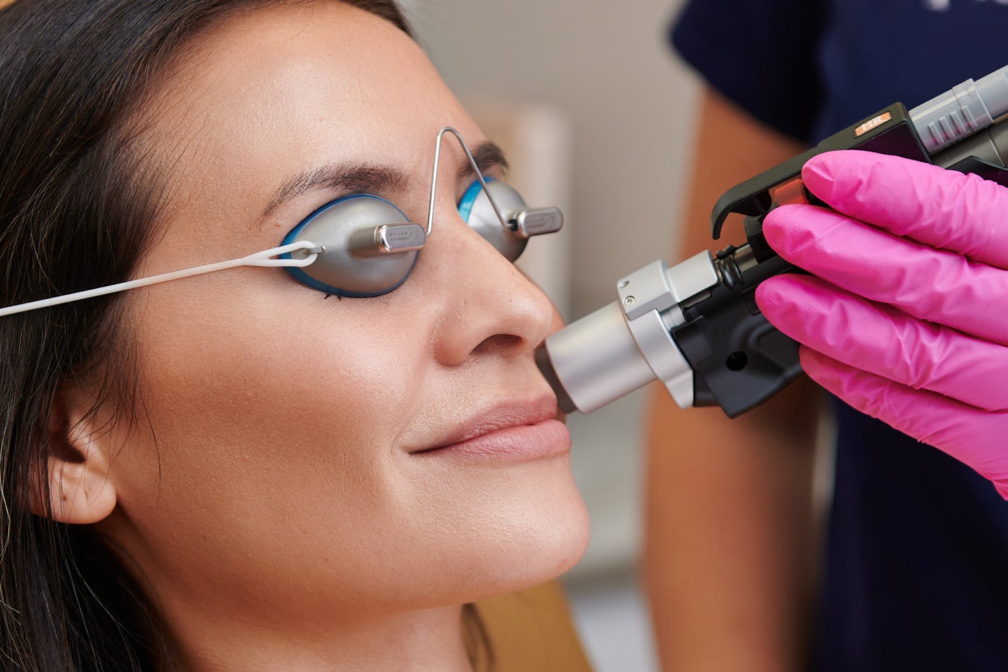 Closeup of a guest during a laser hair removal treatment in the upper lip area.