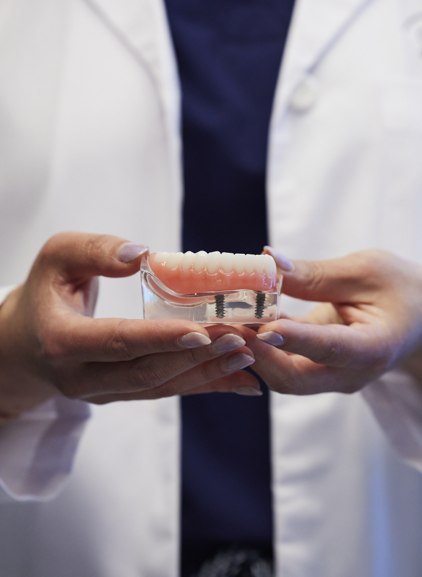  A ClearChoice professional holds a detailed model of a dental implant system, demonstrating how dental implants work to replace missing teeth securely and effectively.