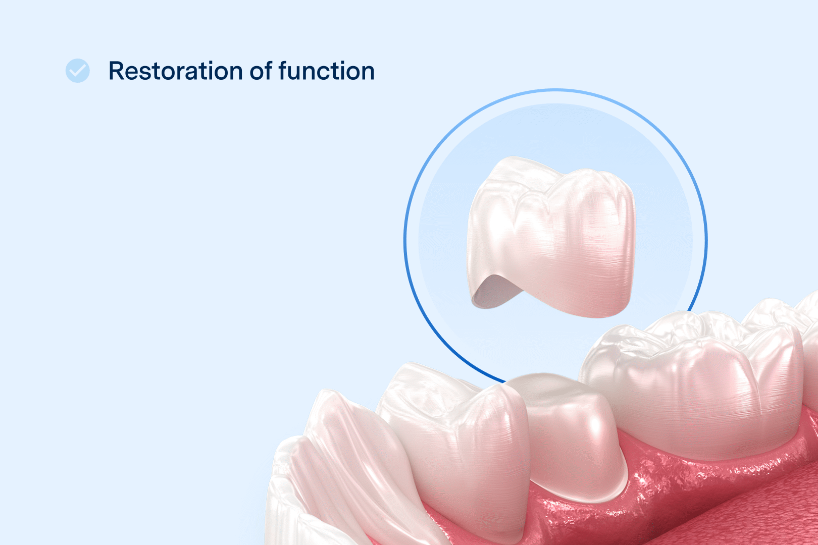 A gif of a detailed animation of a bottom row of teeth, with a circled dental crown highlighted above the row of teeth. The check-marked list then populates in order as such: "Restoration of function", "Aesthetic improvement", "Durability", "Protection", "Comfort".