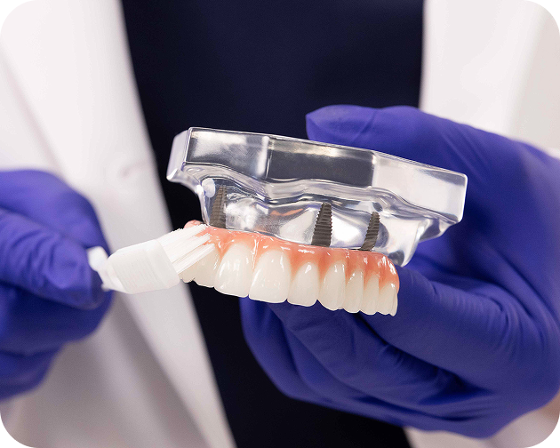 Brushing a fixed full arch dental implant model with a soft toothbrush – Aspen Dental cleaning guide.
