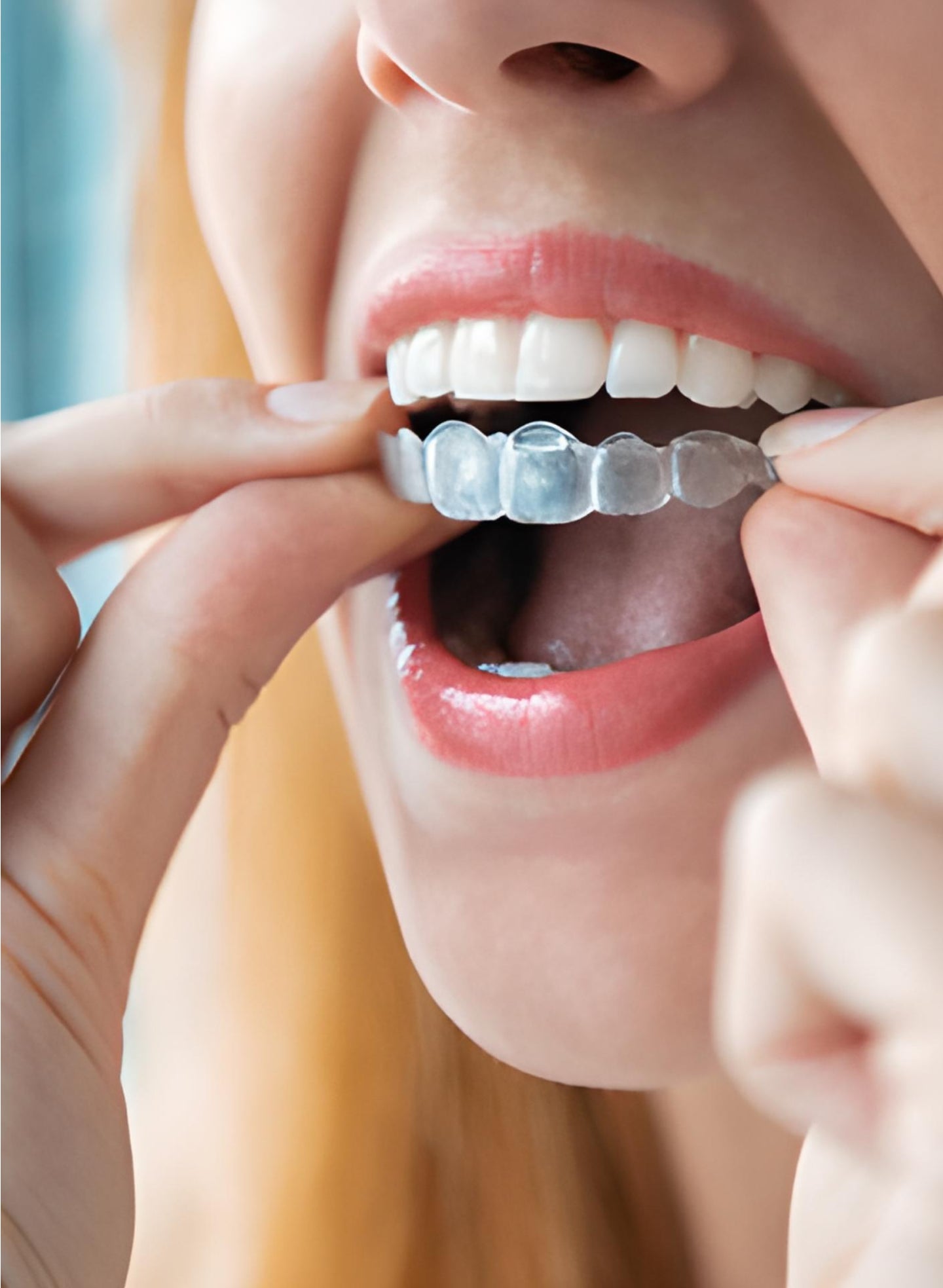 How to clean your retainer