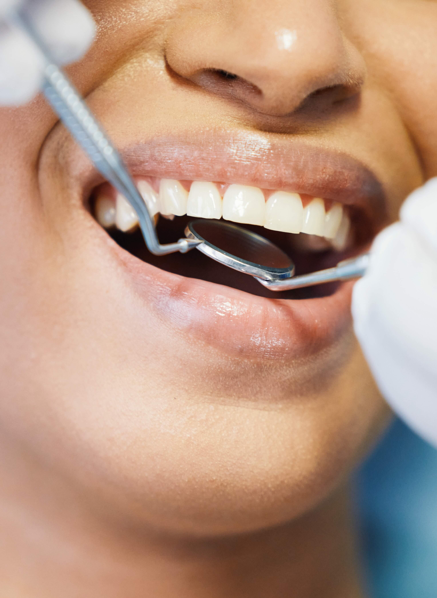 Close-up of a dentist performing a post-extraction checkup with dental tools in a patient’s mouth, illustrating care and prevention of bleeding after tooth extraction at Aspen Dental.
