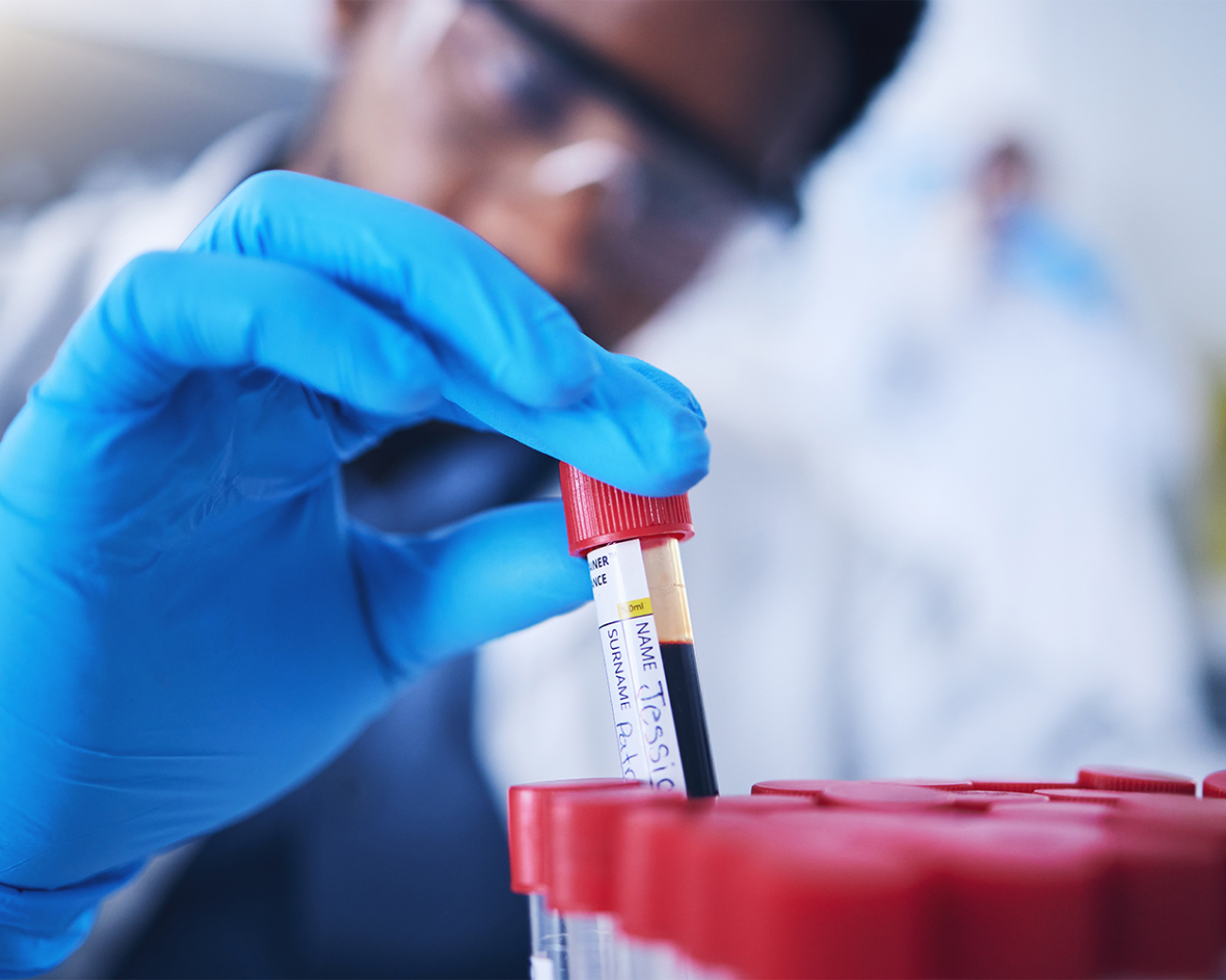 A close up photo of a lab technician submitting a blood sample.