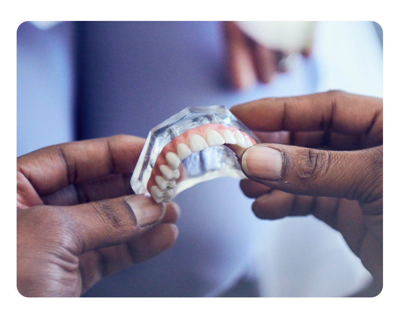 Hands holding a clear dental model showcasing a full upper arch of dental implants with realistic gum and tooth design, representing ClearChoice solutions.