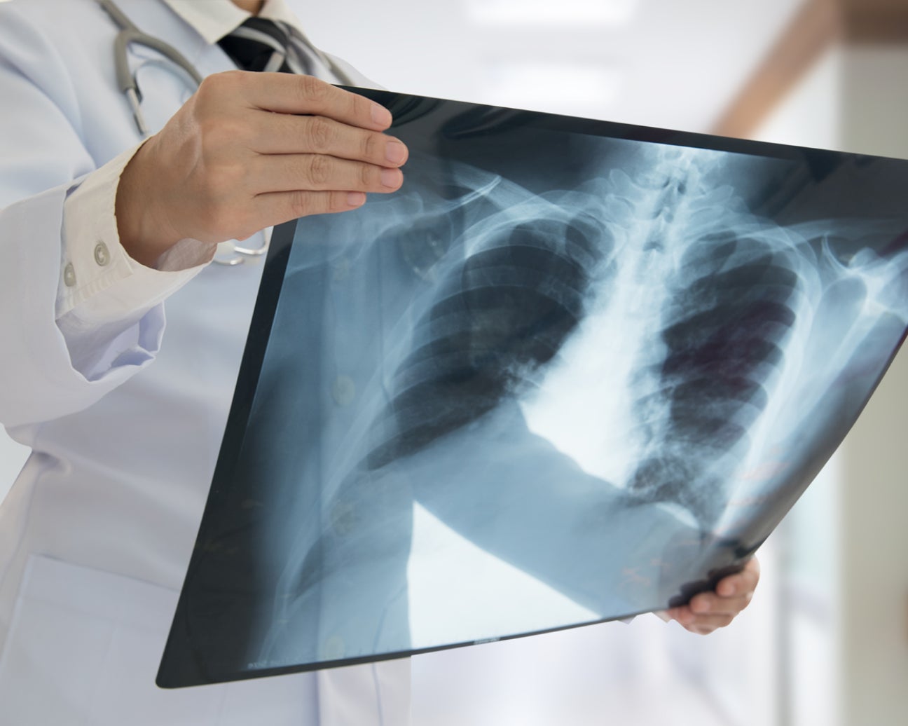 a close up of a medical provider examining an x-ray.